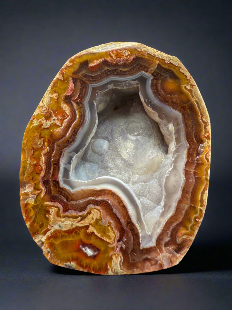 High-Grade Turkish Agate with Botryoidal Chalcedony Vug – Rare Collector’s Gem